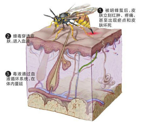 刚好前天就有两个,医生不是在现场,我没办法判断是红火蚁还是普通蚂蚁