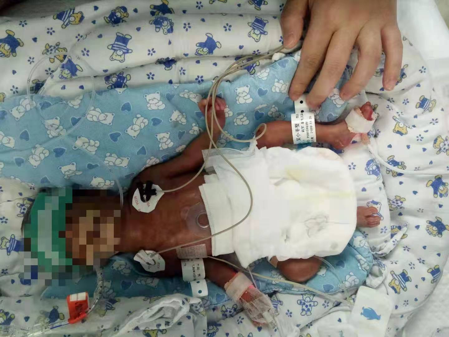 早产儿出院的注意事项 - 健康科普 - 六盘水妇幼保健院