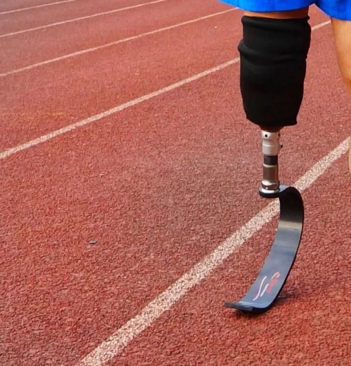 10多年前,李怀忠看到了j型碳纤义肢.