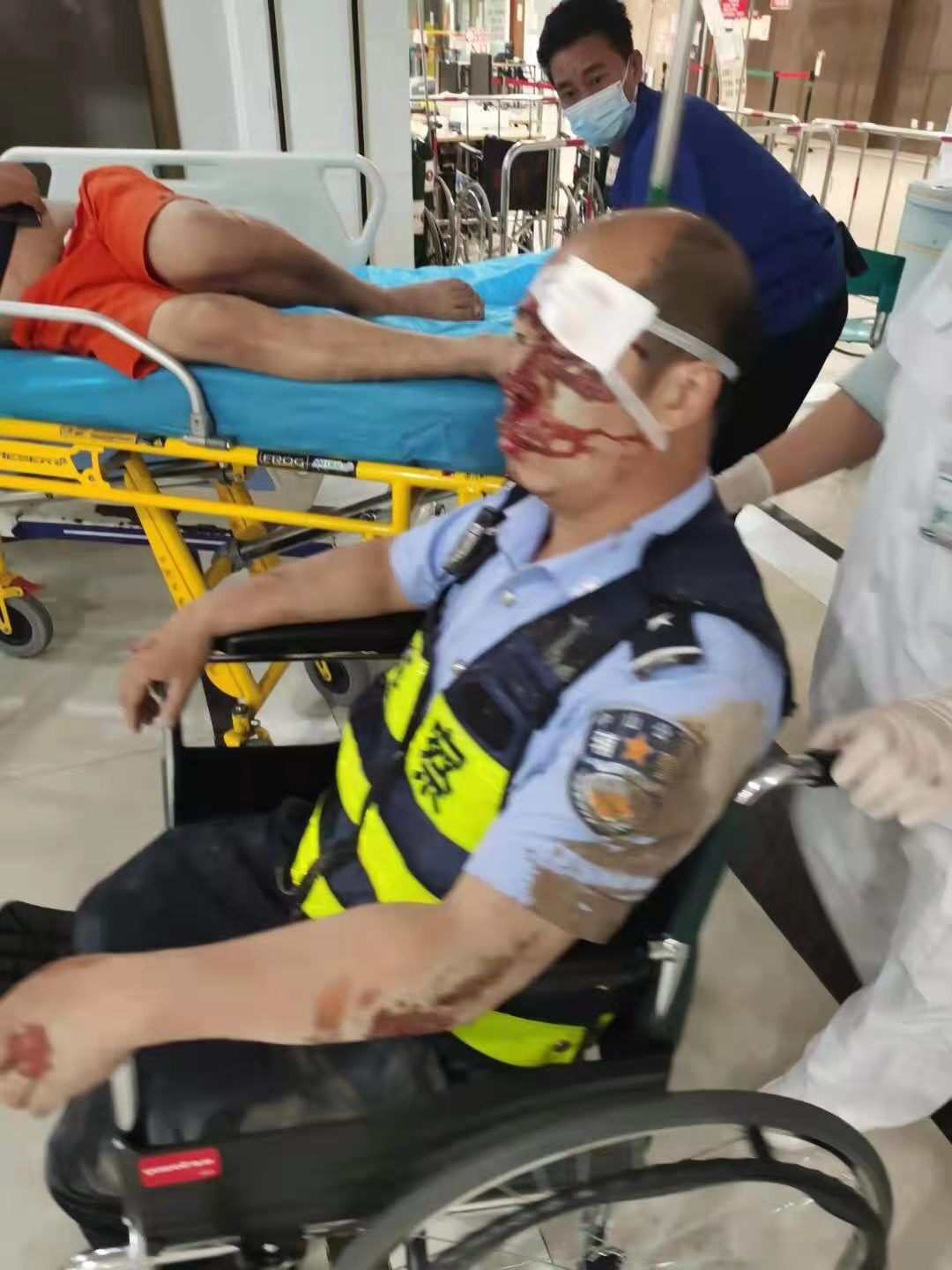 中山一司机酒后驾车撞伤两警察还逃逸,导致两个人受伤!